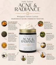 Load image into Gallery viewer, Tally Tallow Acne Radiance